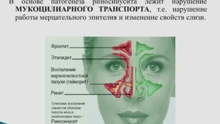 Как вылечить насморк в домашних условиях